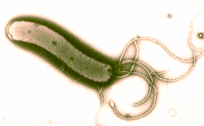 Helicobacter pylori. From Professor D. J. Kelly.